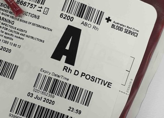 krew-podczas-porodu-ile-tracimy-i-kiedy-to-moze-byc-niebezpieczne