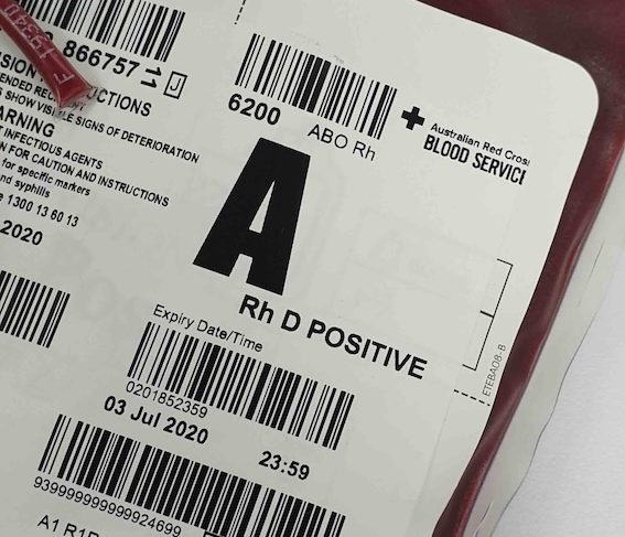 krew-podczas-porodu-ile-tracimy-i-kiedy-to-moze-byc-niebezpieczne